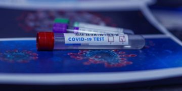 Clearing the confusion around Covid-19 test results in Uganda